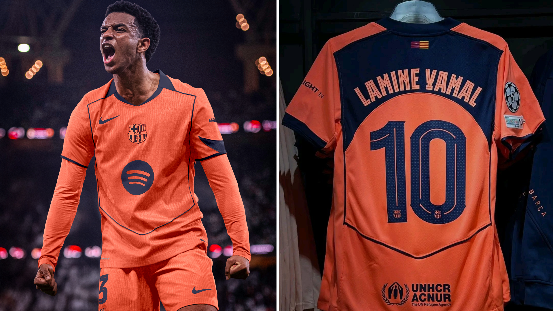 How Much Does the Barcelona Total 90 Kit Cost and Where Can You